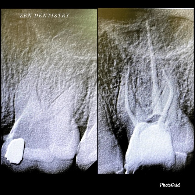 The image shows three X-rays of a human mouth, with each panel focusing on different aspects of dental health, including a close-up view of teeth and gums, an overview of a dental implant procedure, and a detailed look at a tooth extraction process.