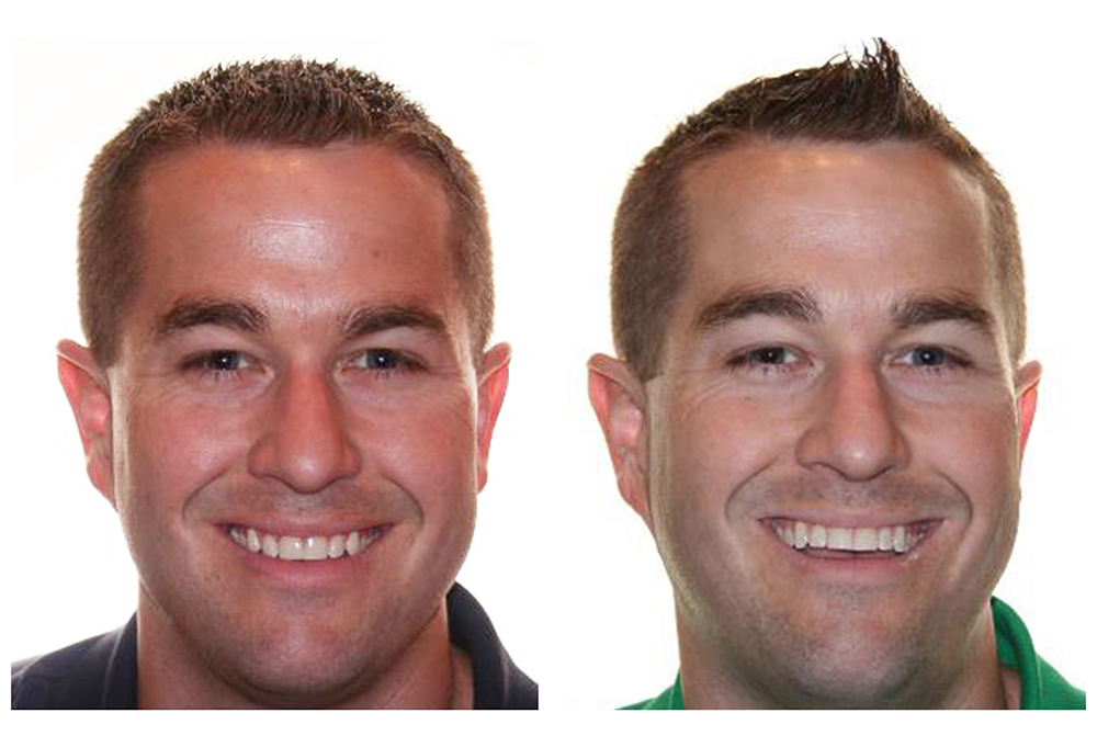 Fuller Smiles San Fernando Valley