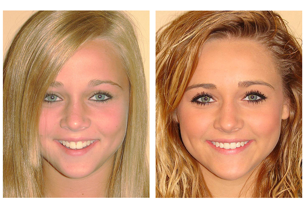 Fuller Smiles San Fernando Valley