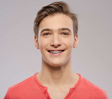 The image shows two close-up photographs of a person, likely a young adult male, with a neutral expression, against a white background.